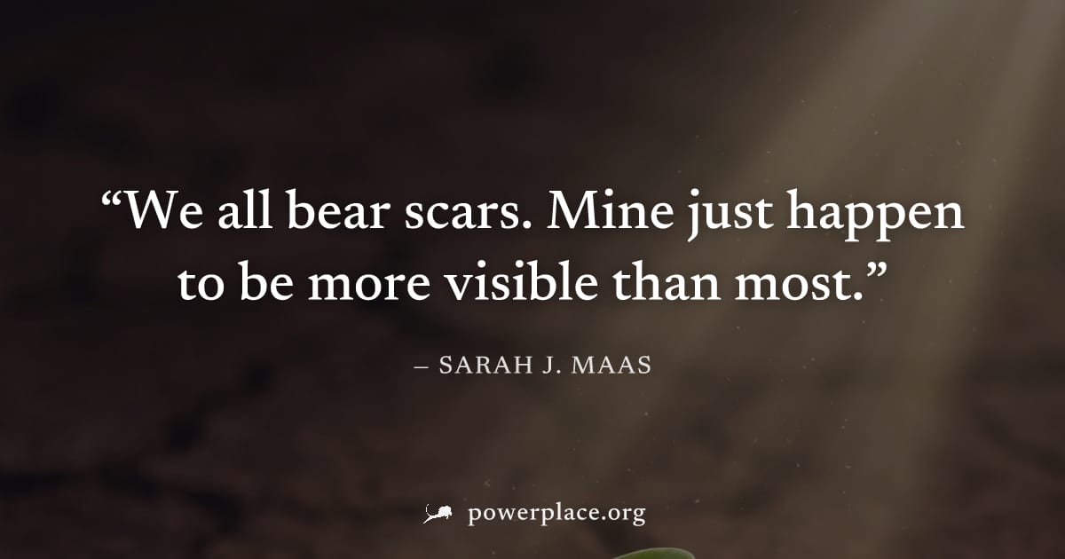 "We all bear scars. Mine just happen to be more visible than most." — Sarah J. Maas