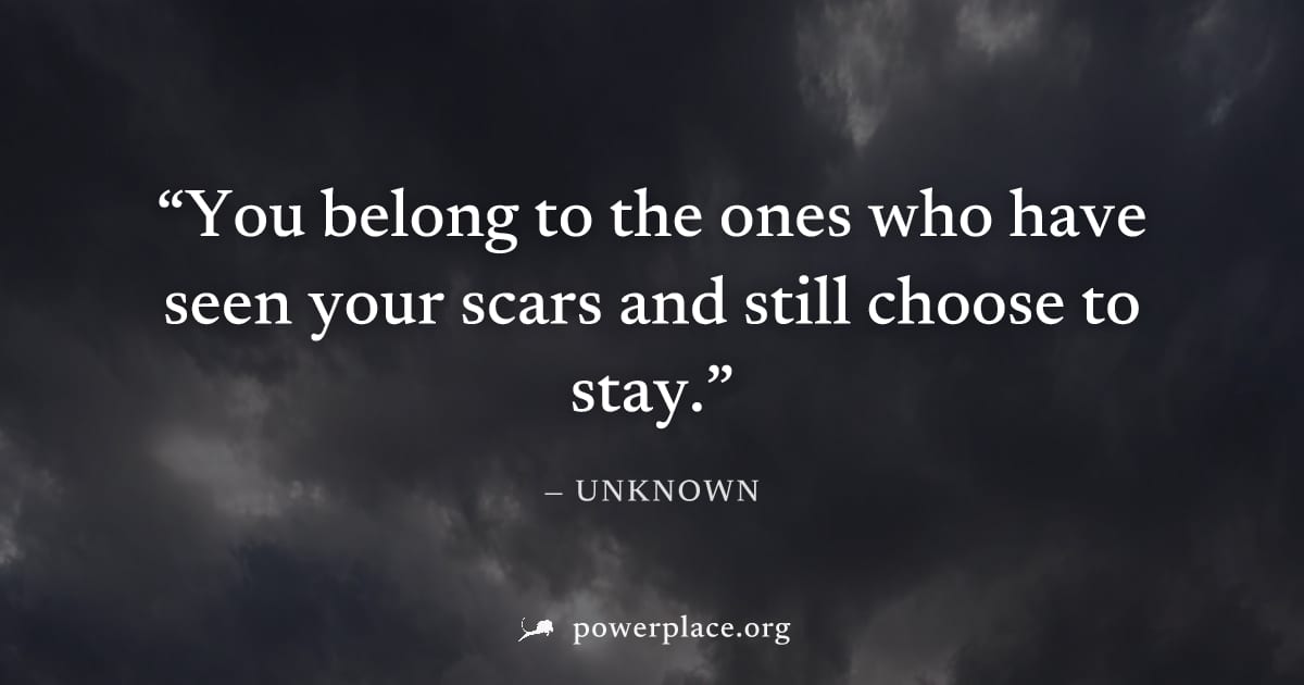 "You belong to the ones who have seen your scars and still choose to stay." — Unknown